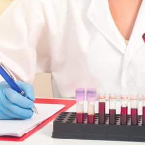 تحاليل وظائف الكلى والكبد