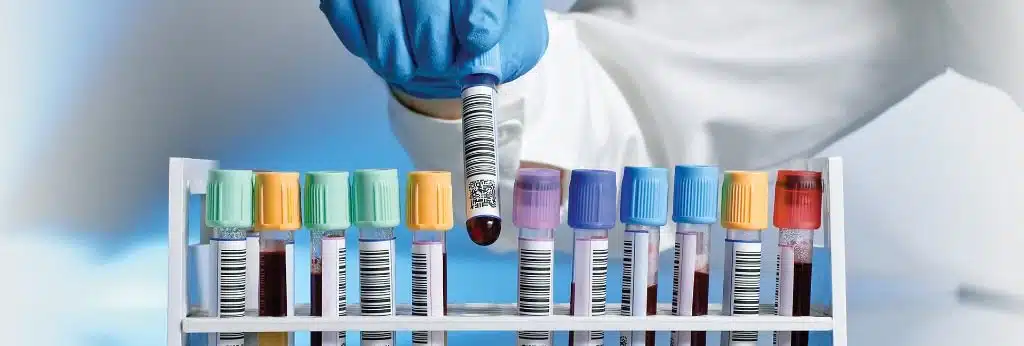 علم المناعة