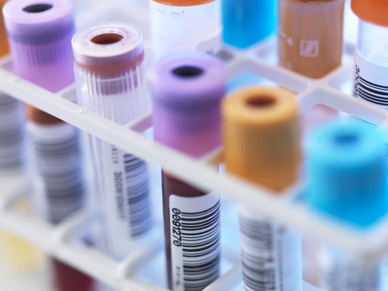 الحساسية والحساسية الجزيئية