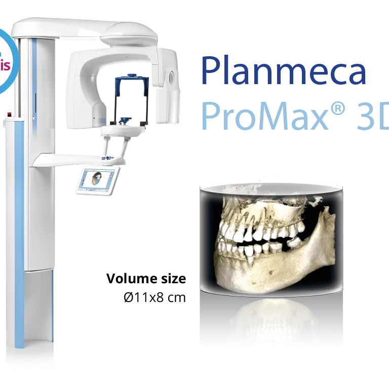 اشعة مقطعية مخروطية على الاسنان