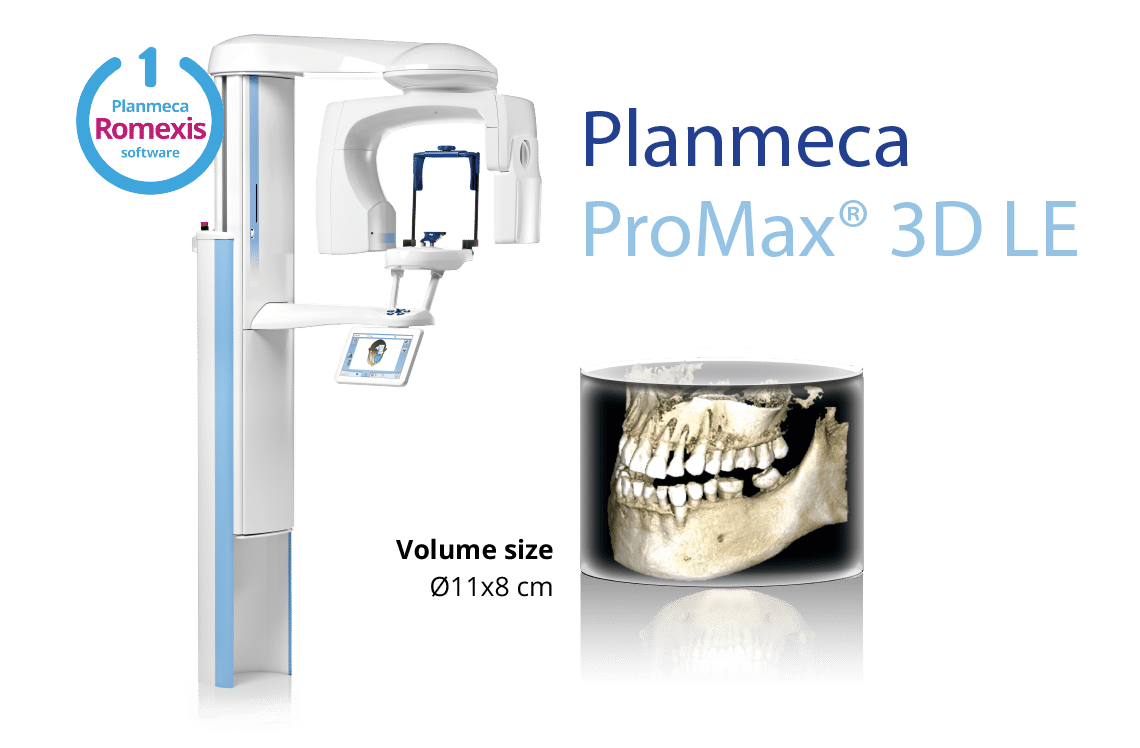 اشعة مقطعية مخروطية على الاسنان