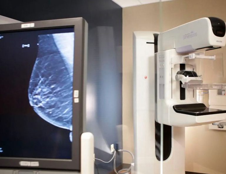 التصوير الشعاعى للثدى