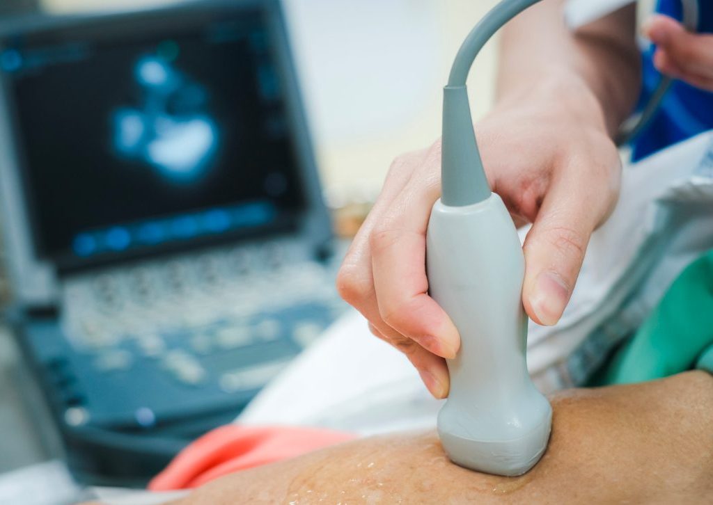 موجات صوتية على القلب