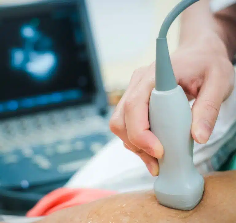 موجات صوتية على القلب