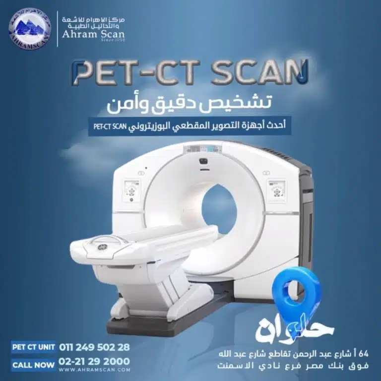 المسح البوزيترونى