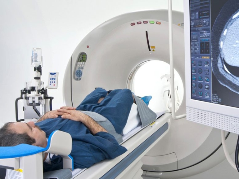 PET‑CT في مراقبة العلاج