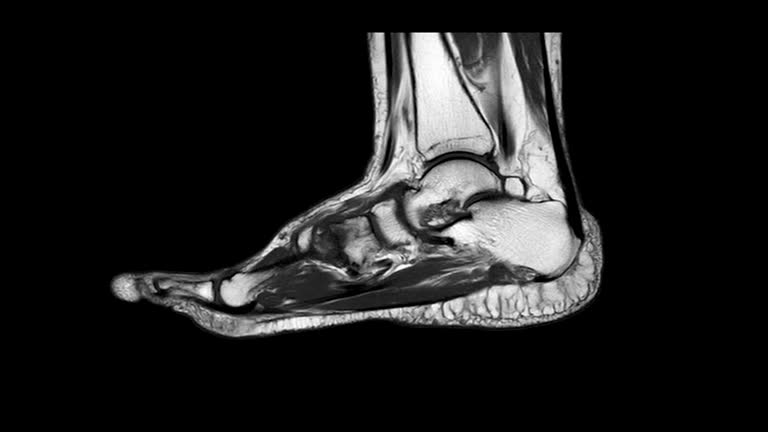 اشعة رنين مغناطيسي للإصابات