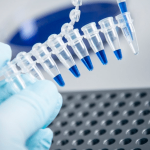 تكلفة تحليل PCR في مصر