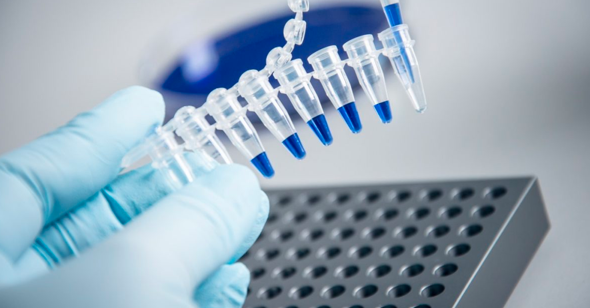 تكلفة تحليل PCR في مصر