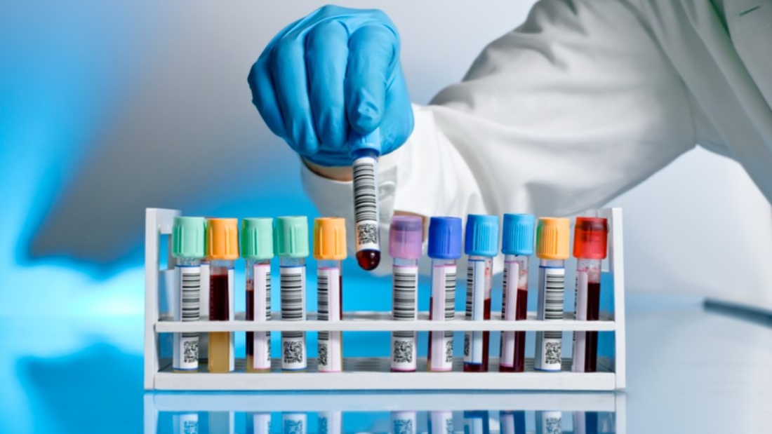 دورة حياة نتيجة تحليل PCR