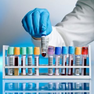 دورة حياة نتيجة تحليل PCR