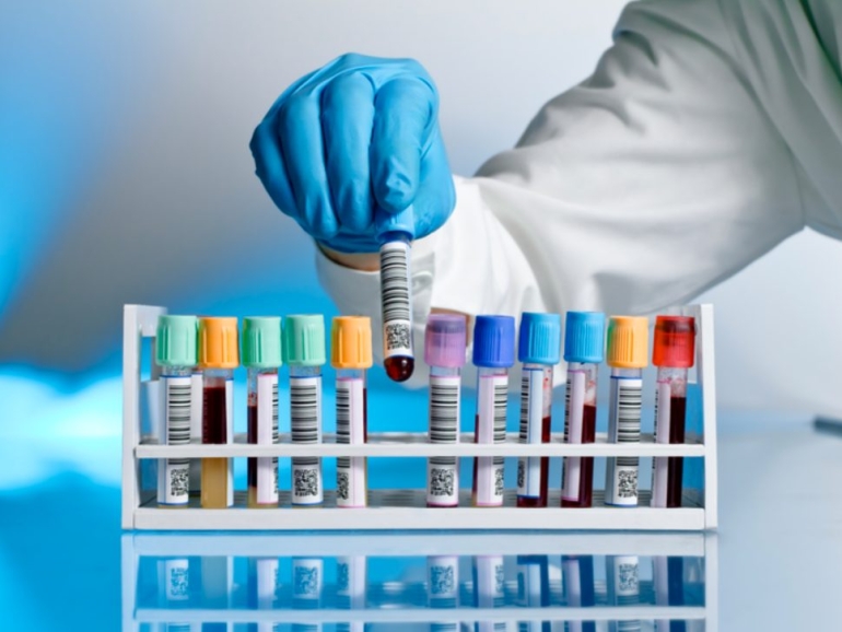 دورة حياة نتيجة تحليل PCR