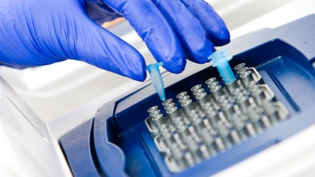 مقارنة تحليل PCR
