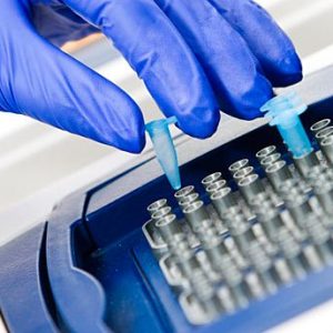 مقارنة تحليل PCR