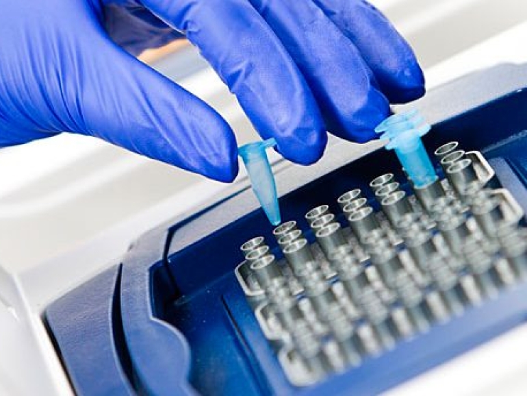 مقارنة تحليل PCR