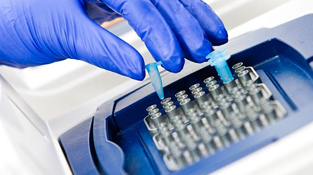مقارنة تحليل PCR