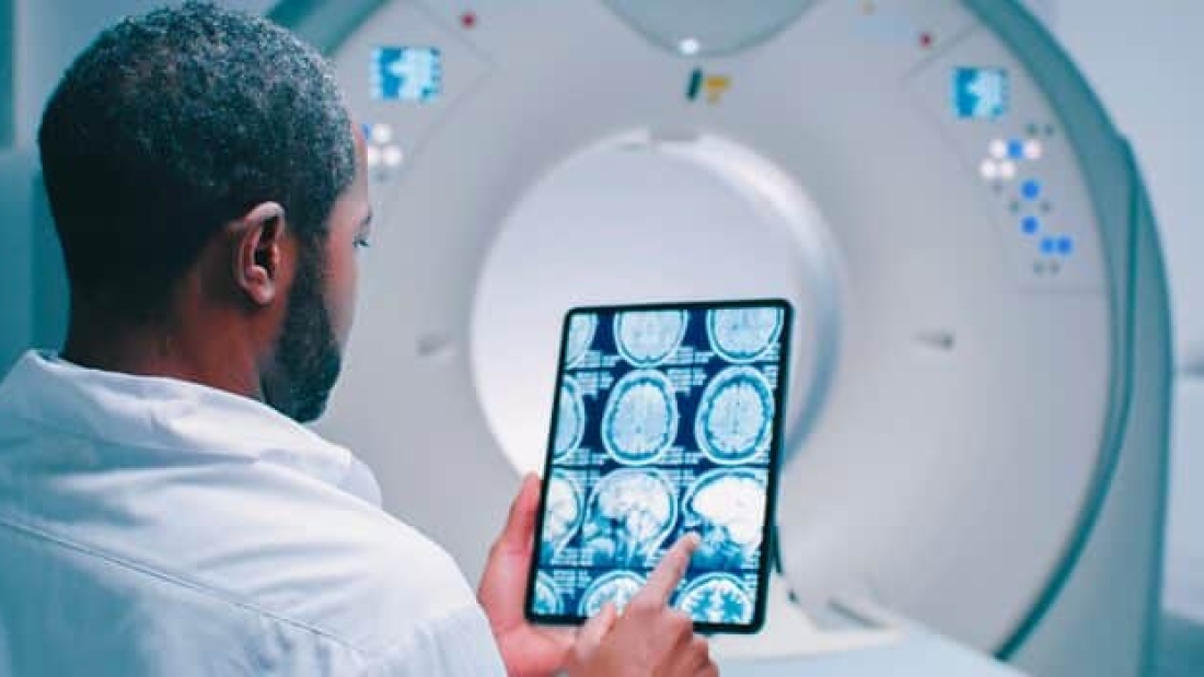 أشعة mri