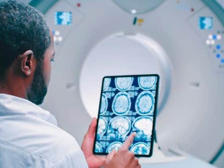 أشعة mri