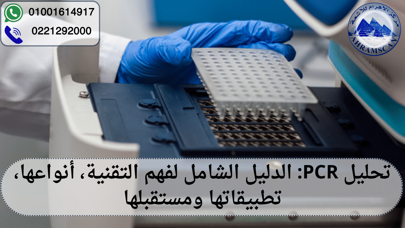 تحليل PCR