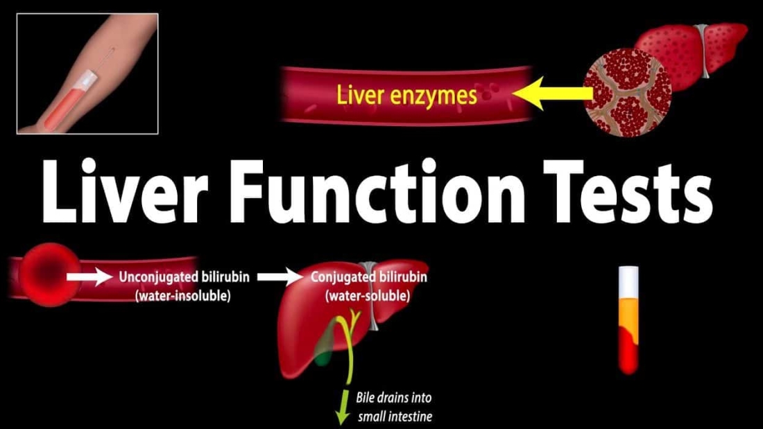 تحليل وظائف الكبد