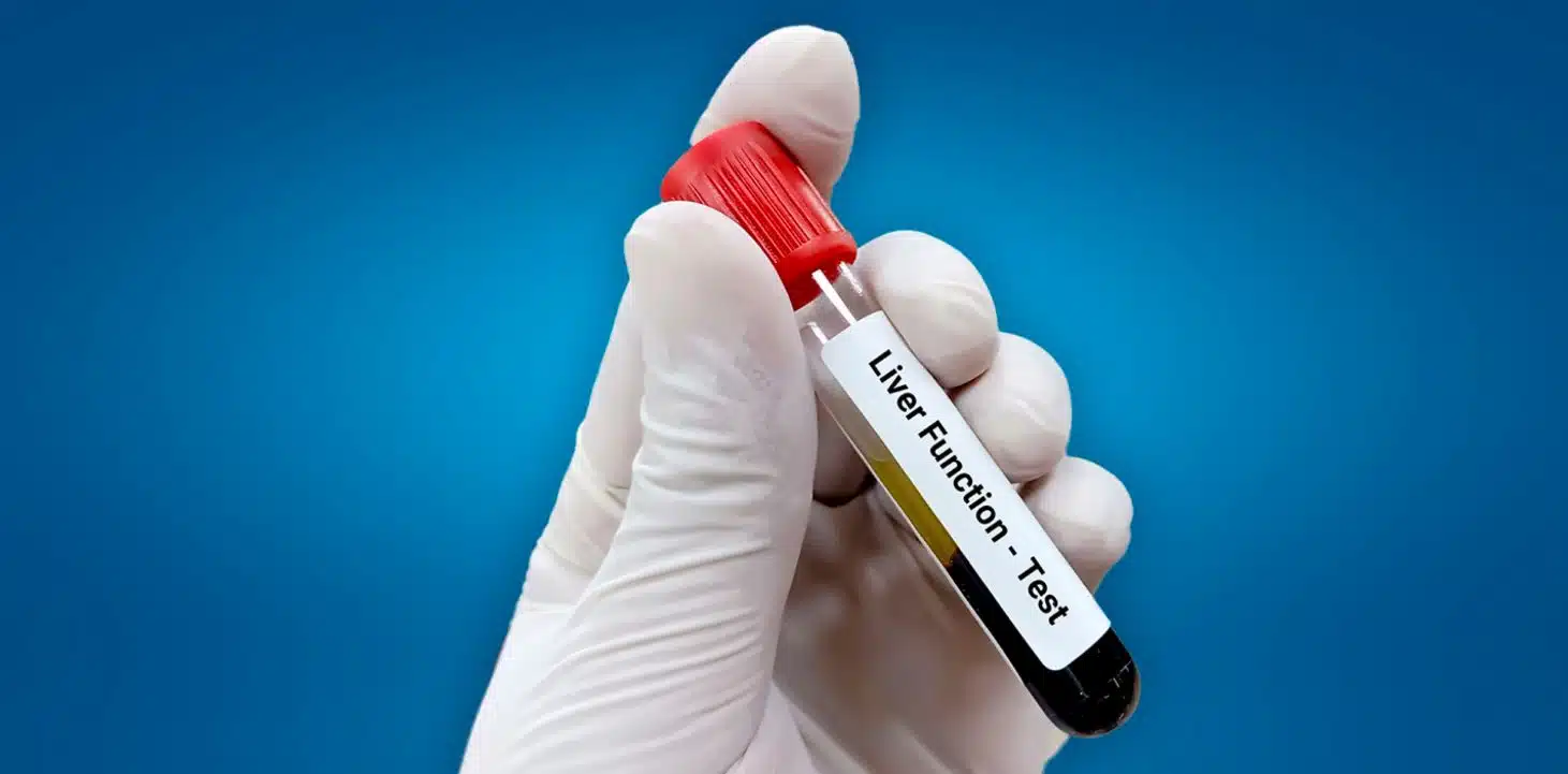 سعر تحليل وظائف الكبد في مصر