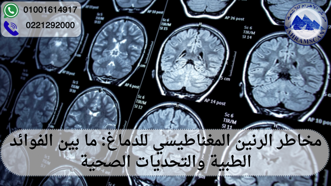 مخاطر الرنين المغناطيسي للدماغ