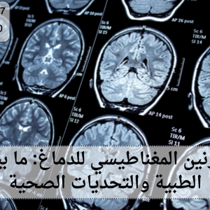 مخاطر الرنين المغناطيسي للدماغ
