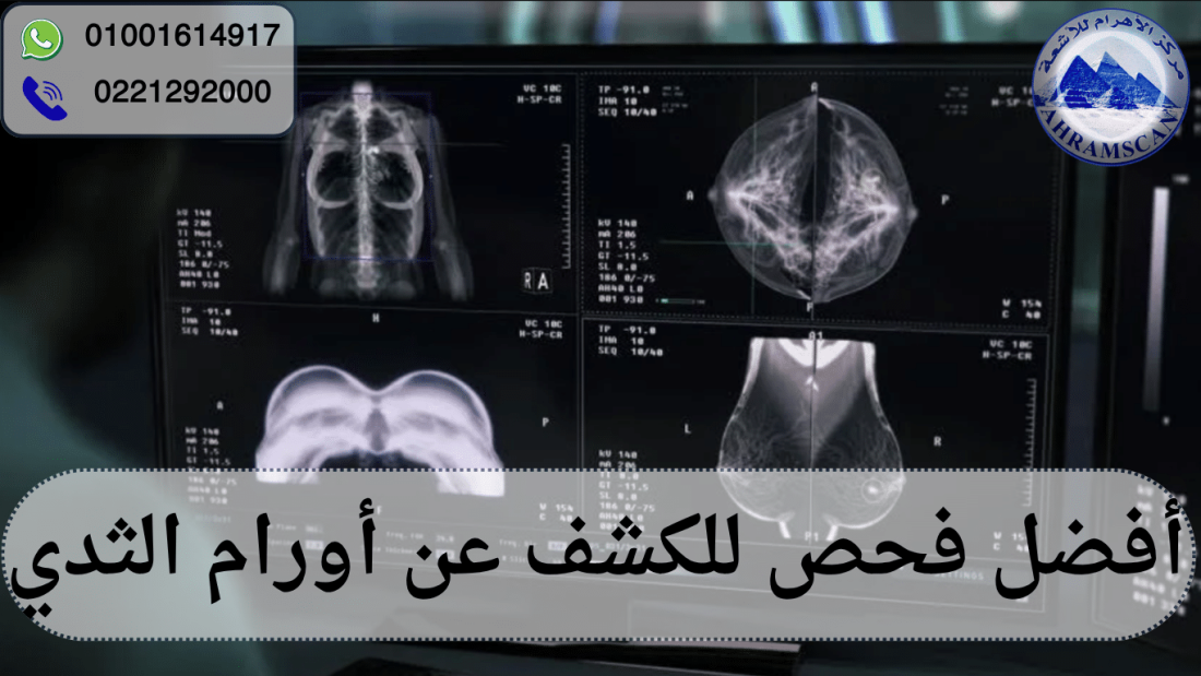 أفضل فحص للكشف عن أورام الثدي