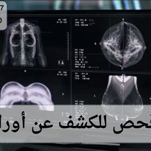 أفضل فحص للكشف عن أورام الثدي