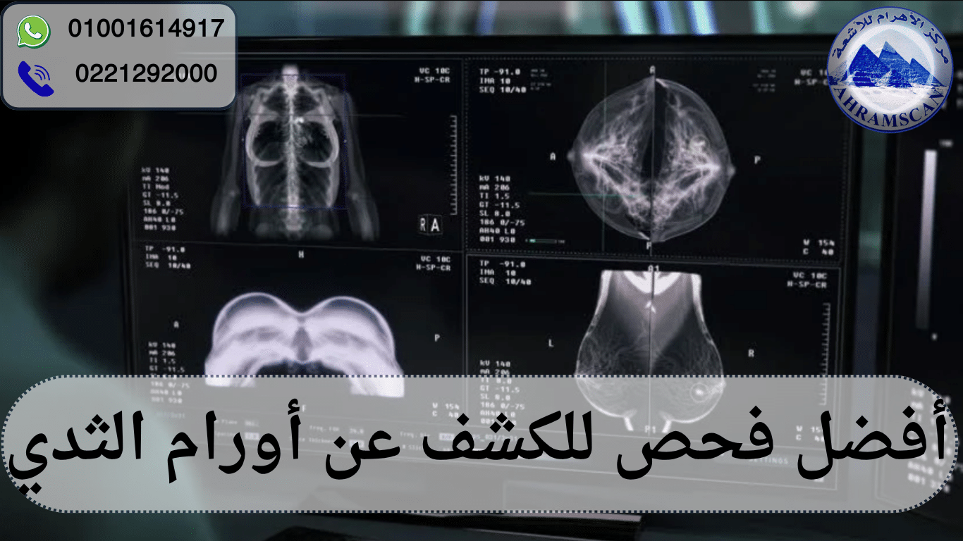 أفضل فحص للكشف عن أورام الثدي