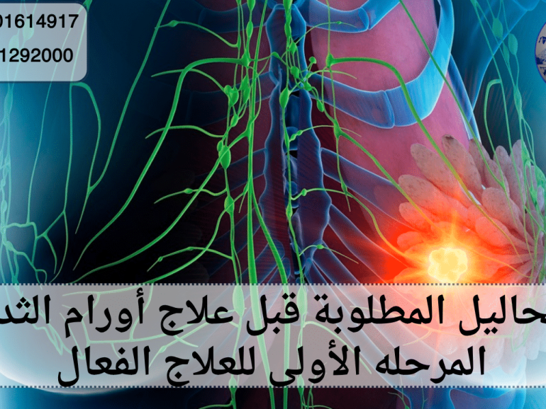 التحاليل المطلوبة قبل علاج أورام الثدي