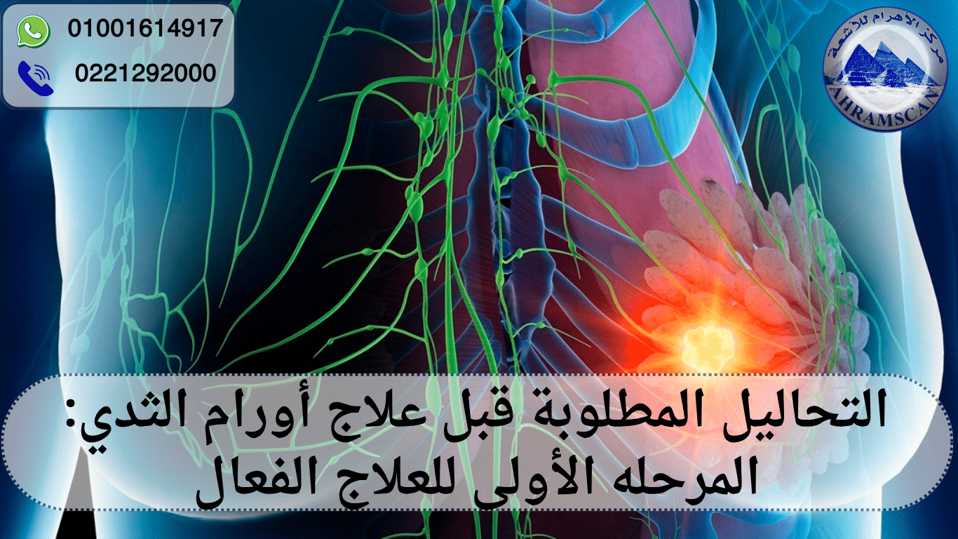 التحاليل المطلوبة قبل علاج أورام الثدي