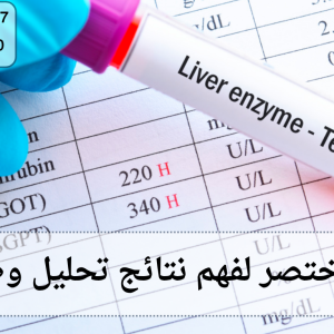 تحليل وظائف كبد
