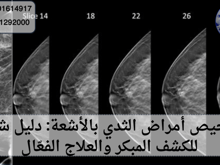 تشخيص أمراض الثدي بالأشعة