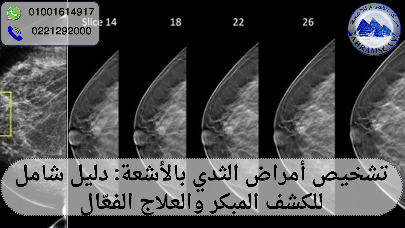 تشخيص أمراض الثدي بالأشعة