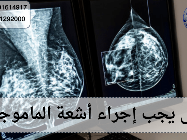 متى يجب إجراء أشعة الماموجرام