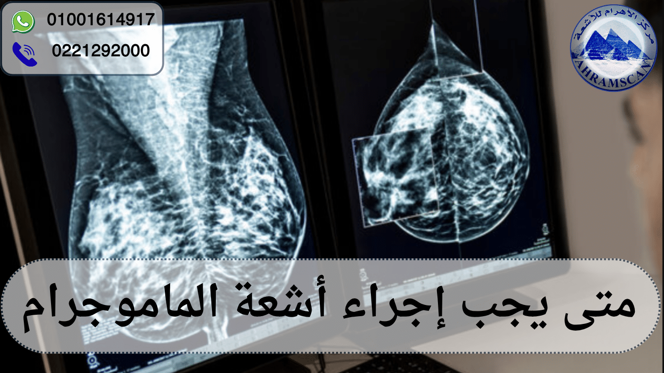 متى يجب إجراء أشعة الماموجرام