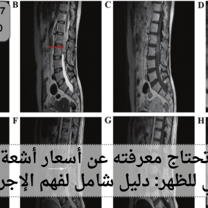 أسعار أشعة الرنين المغناطيسي للظهر