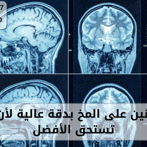 أشعة رنين على المخ