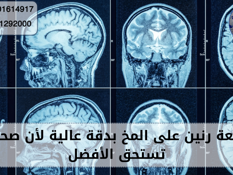 أشعة رنين على المخ