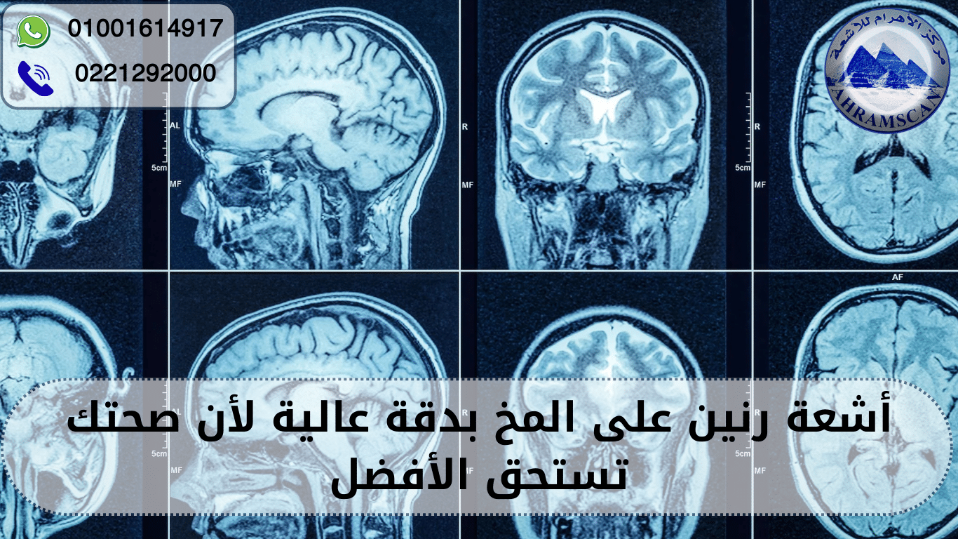 أشعة رنين على المخ