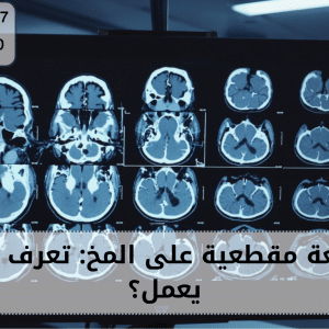 اشعة مقطعية على المخ