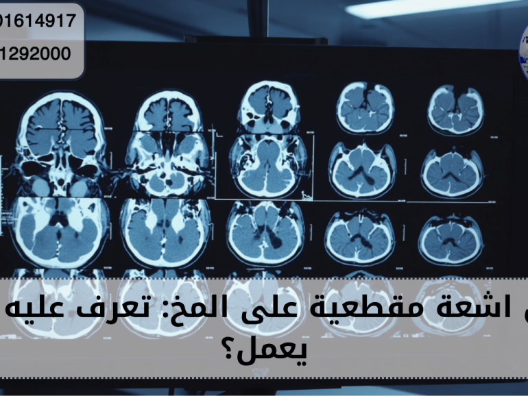 اشعة مقطعية على المخ