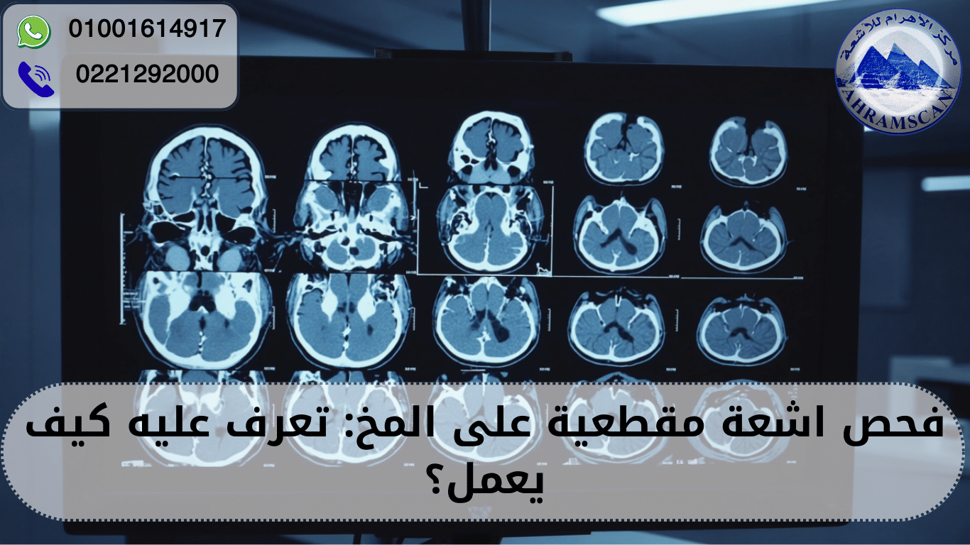 اشعة مقطعية على المخ
