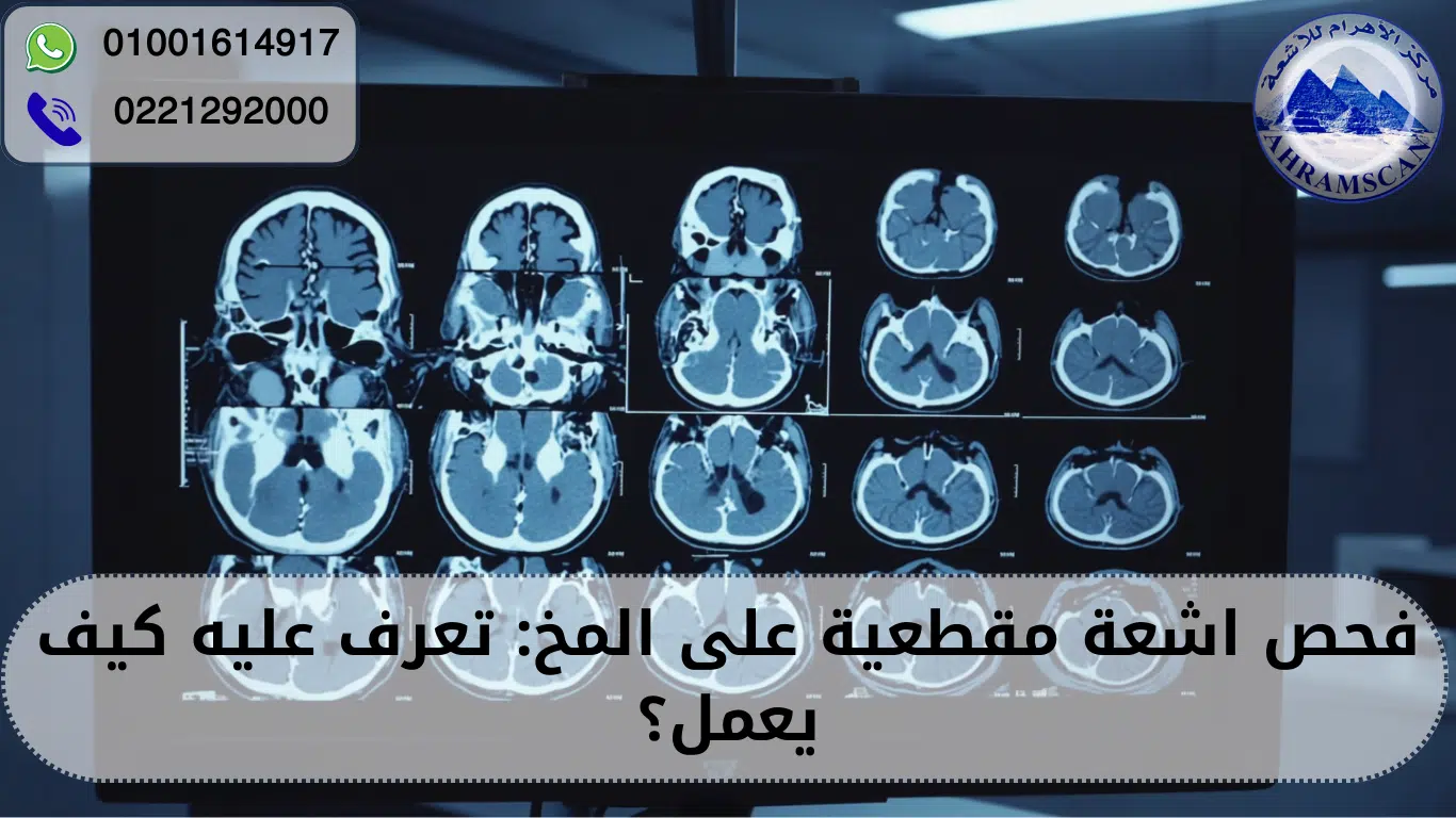 اشعة مقطعية على المخ