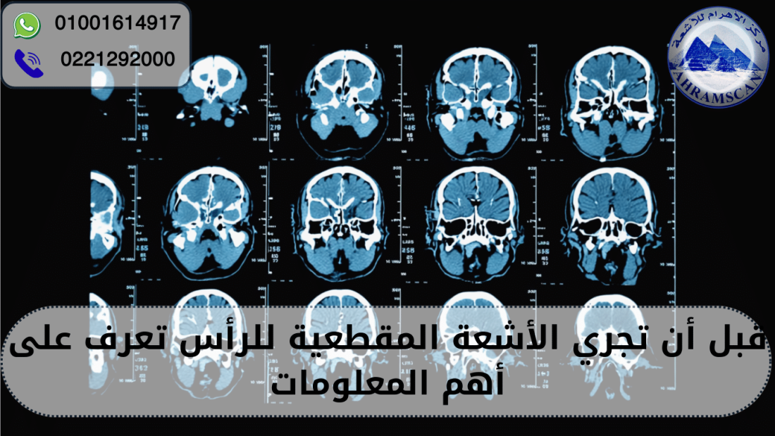 الأشعة المقطعية للراس