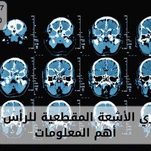 الأشعة المقطعية للراس