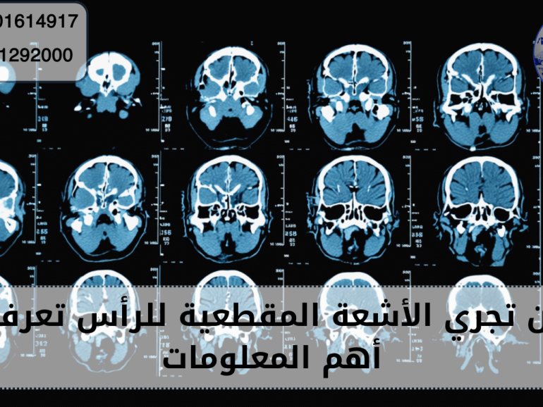 الأشعة المقطعية للراس