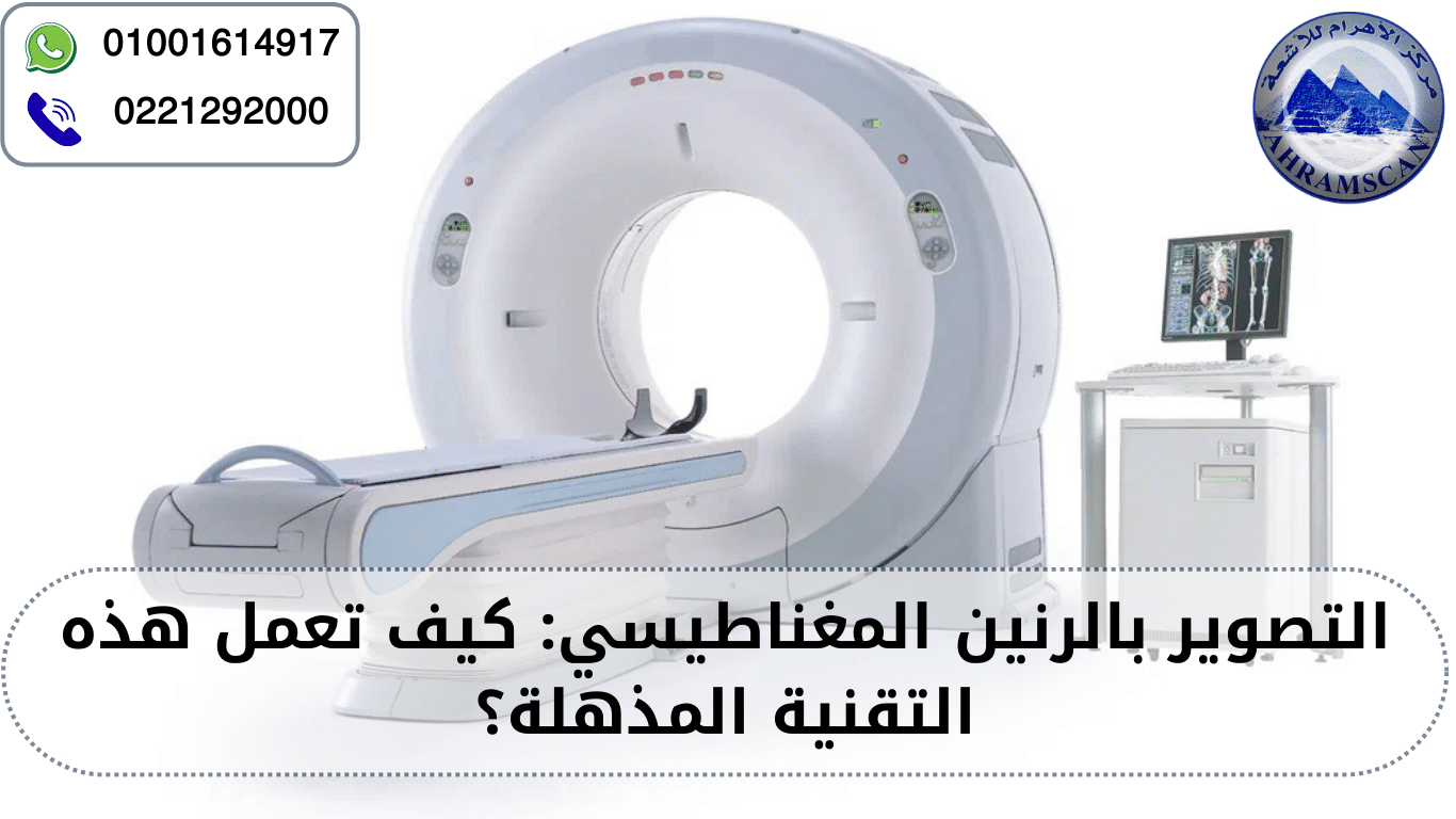 التصوير بالرنين المغناطيسي