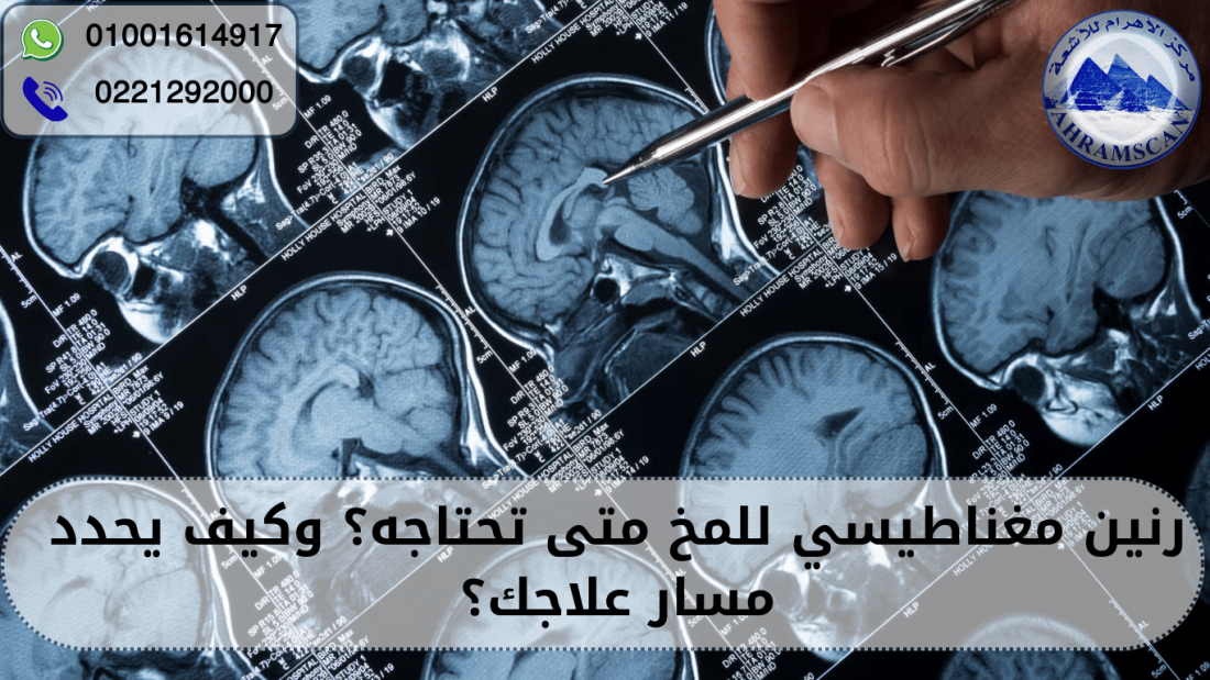 رنين مغناطيسي للمخ